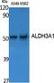 Aldehyde Dehydrogenase 3 Family Member A1 antibody, A01121-1, Boster Biological Technology, Western Blot image 