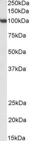 Sp1 Transcription Factor antibody, LS-C305884, Lifespan Biosciences, Western Blot image 