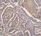 Insulin Receptor Substrate 1 antibody, M00268-1, Boster Biological Technology, Immunohistochemistry frozen image 