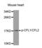 Cofilin 1 antibody, MBS128417, MyBioSource, Western Blot image 