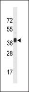 Motor Neuron And Pancreas Homeobox 1 antibody, GTX53647, GeneTex, Western Blot image 