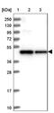 SDS3 Homolog, SIN3A Corepressor Complex Component antibody, NBP2-48751, Novus Biologicals, Western Blot image 