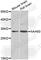 N(Alpha)-Acetyltransferase 60, NatF Catalytic Subunit antibody, A7386, ABclonal Technology, Western Blot image 