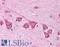 Sodium channel subunit beta-3 antibody, LS-B160, Lifespan Biosciences, Immunohistochemistry paraffin image 