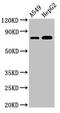 TBC1 Domain Family Member 15 antibody, LS-C672313, Lifespan Biosciences, Western Blot image 