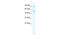 Cholinergic Receptor Nicotinic Beta 2 Subunit antibody, 28-714, ProSci, Enzyme Linked Immunosorbent Assay image 