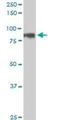 HIC ZBTB Transcriptional Repressor 1 antibody, H00003090-M01, Novus Biologicals, Western Blot image 