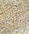 UDP Glucuronosyltransferase Family 2 Member B17 antibody, abx032833, Abbexa, Immunohistochemistry frozen image 