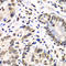 RB Binding Protein 7, Chromatin Remodeling Factor antibody, LS-C346162, Lifespan Biosciences, Immunohistochemistry paraffin image 