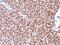 NK2 Homeobox 2 antibody, M04740, Boster Biological Technology, Immunohistochemistry paraffin image 