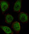 Protein Phosphatase 1 Catalytic Subunit Beta antibody, LS-C101012, Lifespan Biosciences, Immunofluorescence image 