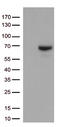 Matrix Metallopeptidase 2 antibody, LS-C798975, Lifespan Biosciences, Western Blot image 