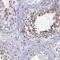 Coiled-Coil Domain Containing 36 antibody, PA5-61072, Invitrogen Antibodies, Immunohistochemistry frozen image 
