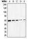 SRC Proto-Oncogene, Non-Receptor Tyrosine Kinase antibody, MBS8214818, MyBioSource, Western Blot image 