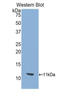 Solute Carrier Family 2 Member 1 antibody, LS-C300895, Lifespan Biosciences, Western Blot image 