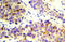 Checkpoint Kinase 2 antibody, AP21020PU-N, Origene, Immunohistochemistry paraffin image 