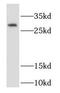 RAB32, Member RAS Oncogene Family antibody, FNab07016, FineTest, Western Blot image 