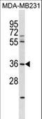 Ring Finger Protein 217 antibody, LS-C158873, Lifespan Biosciences, Western Blot image 