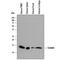 S100 Calcium Binding Protein A9 antibody, AF5578, R&D Systems, Western Blot image 