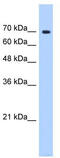 SURP and G-patch domain-containing protein 1 antibody, TA343903, Origene, Western Blot image 