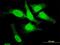 DNA Topoisomerase III Beta antibody, H00008940-M05, Novus Biologicals, Immunocytochemistry image 