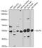 Solute Carrier Family 2 Member 4 antibody, 23-070, ProSci, Western Blot image 