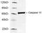Caspase 10 antibody, LS-C203071, Lifespan Biosciences, Western Blot image 