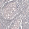 Long-chain-fatty-acid--CoA ligase 3 antibody, HPA011315, Atlas Antibodies, Immunohistochemistry frozen image 