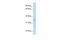 MAX Dimerization Protein MLX antibody, PA5-41683, Invitrogen Antibodies, Western Blot image 