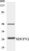 NADH:Ubiquinone Oxidoreductase Core Subunit V2 antibody, LS-C200263, Lifespan Biosciences, Western Blot image 