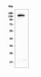 Large Tumor Suppressor Kinase 1 antibody, A01051-2, Boster Biological Technology, Western Blot image 