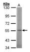 N-Sulfoglucosamine Sulfohydrolase antibody, NBP1-32061, Novus Biologicals, Western Blot image 