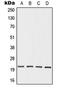 Ornithine Decarboxylase Antizyme 3 antibody, GTX55956, GeneTex, Western Blot image 