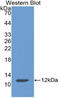 Cystatin A antibody, LS-C314178, Lifespan Biosciences, Western Blot image 