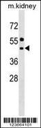 Asparagine-linked glycosylation protein 11 homolog antibody, 59-672, ProSci, Western Blot image 