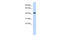 Sphingomyelin Synthase 2 antibody, 26-739, ProSci, Enzyme Linked Immunosorbent Assay image 