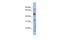 RAB3A Interacting Protein antibody, PA5-44021, Invitrogen Antibodies, Western Blot image 