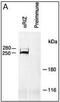 PR/SET Domain 2 antibody, PA5-11295, Invitrogen Antibodies, Immunoprecipitation image 