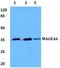 MAGE Family Member A6 antibody, A07982, Boster Biological Technology, Western Blot image 