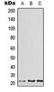 Activating Transcription Factor 3 antibody, MBS8236685, MyBioSource, Western Blot image 