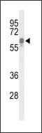 Inositol-Trisphosphate 3-Kinase C antibody, 63-898, ProSci, Western Blot image 