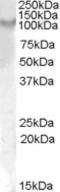 Interleukin 17 Receptor A antibody, STJ71222, St John