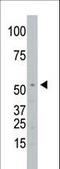 Signal peptide peptidase-like 2A antibody, LS-C100059, Lifespan Biosciences, Western Blot image 