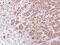 Proteasome Subunit Alpha 7 antibody, PA5-22289, Invitrogen Antibodies, Immunohistochemistry frozen image 