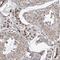 Mitochondrial Ribosomal Protein S15 antibody, NBP1-82319, Novus Biologicals, Immunohistochemistry paraffin image 