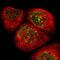 RAD18 E3 Ubiquitin Protein Ligase antibody, PA5-52602, Invitrogen Antibodies, Immunofluorescence image 