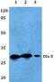 Distal-Less Homeobox 5 antibody, A02523, Boster Biological Technology, Western Blot image 