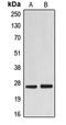 Eukaryotic Translation Initiation Factor 4E antibody, LS-C352157, Lifespan Biosciences, Western Blot image 