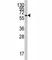 Cytochrome P450 Family 26 Subfamily A Member 1 antibody, F40123-0.4ML, NSJ Bioreagents, Western Blot image 