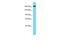 ATPase Family AAA Domain Containing 2B antibody, A13542, Boster Biological Technology, Western Blot image 